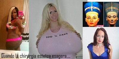 quando la chirurgia estetica esagera